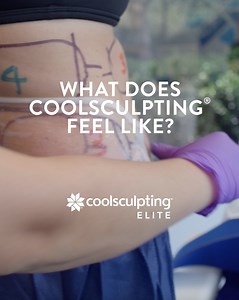 “It feels like your hand is in an ice bucket: it’s just cold!” That’s how Tracey describes her CoolSculpting® treatment, which is a noninvasive option to eliminate stubborn fat and reach body contouring goals. - CoolSculpting® Elite Uses and Important Safety Information CoolSculpting® Elite is FDA-cleared to treat visible fat bulges on the abdomen, flank, thigh, bra fat, back fat, upper arm, and under the buttocks, chin, and jawline. It is also FDA-cleared to affect the appearance of lax tissue 