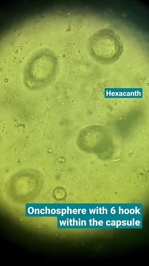 8.9K views · 105 reactions | Stool sample  #lablife #microbiology | Lab life | Facebook
