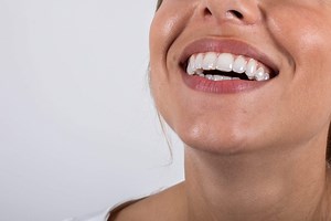 Brackets antes y después - Beneficios de usar ortodoncia