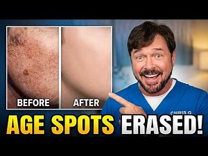 Remove Up to 20 YEARS of Sun Damage With The ONLY Proven Compounds
