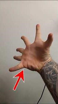 If You Ever See Someone With 6 Fingers, it's Real...