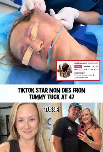Ohio wife and mother Rachel Tussey was taken off life support following complications after a mommy makeover.#fyp #tragedy #surgery #viral #news