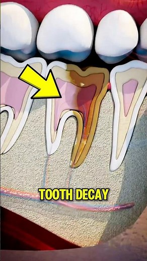 Why You Should NEVER Ignore a Bad Tooth 😱