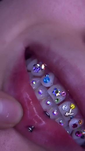 Sick of plain teeth🦷? Our kit comes with colorful gems🌈. How about a change🎨? #fyp #toothgem #toothgems #toothfairy #toothgemz #tiktokshop #viralvideo #toothgems💎 #tiktokshopfinds