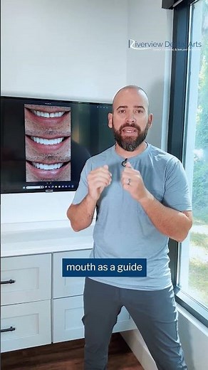 How Does a Smile Makeover Actually Work? Step-by-Step Process | Riverview Dental Arts