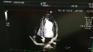 12K views · 101 reactions | This is an example of a virtual echo...