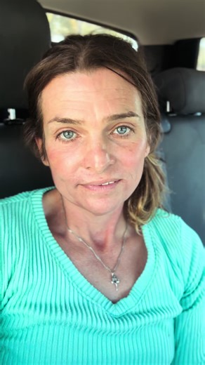 Understanding Male to Female Transgender Laser Hair Removal