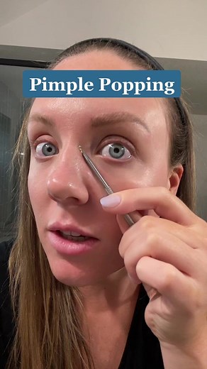 Safe At-Home Pimple Extraction Techniques