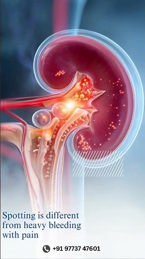 Spotting During Pregnancy: Is It Normal? Causes, Risks & When to See a Doctor