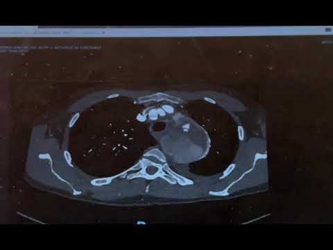 CTA seminar IMG 0045