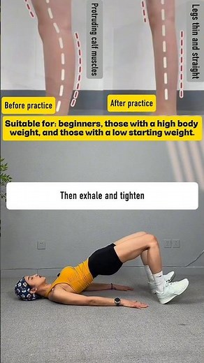 How to Fix Anterior Pelvic Tilt at Home (Easy!)