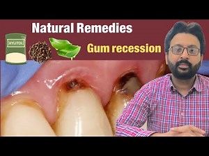 Grow Back Receding Gums Naturally