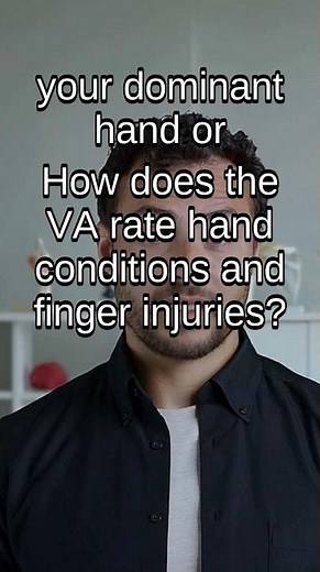Hand & Finger Injuries: VA Disability Ratings Explained