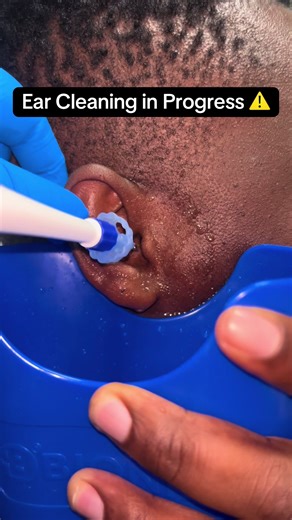 Effective Ear Wax Removal Services