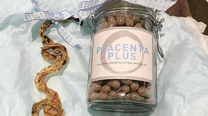 Comer la placenta, la nueva tendencia de los famosos