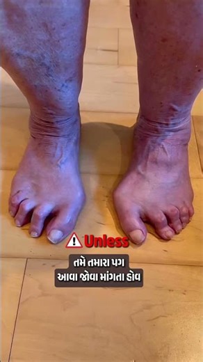 Best Exercises for Strong & Pain-Free Feet 💡