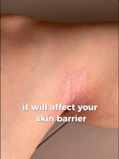 Discover the Benefits of pH 5.5 in Skin Care