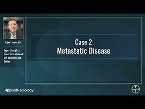 Contrast-Enhanced MR Liver Imaging Video Case Review