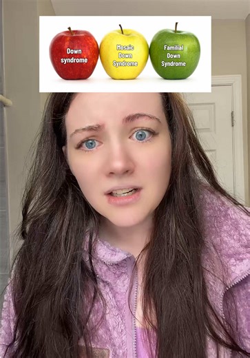 Understanding Mosaic Down Syndrome and Its Impact