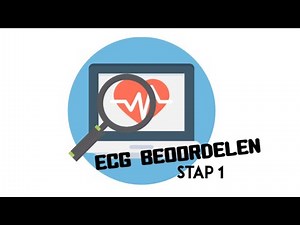 ECG Assessment - Step 1 (Rhythm and Rate)