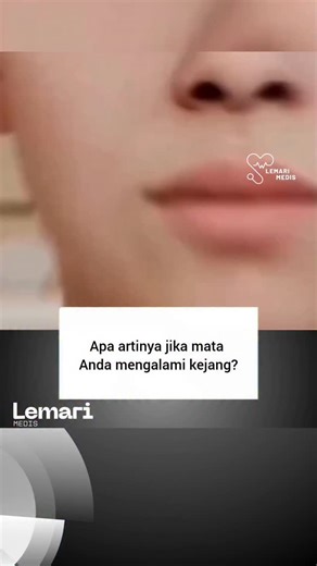 Lemarimedis on Instagram: "Kejang mata adalah kedutan atau kedipan cepat yang tidak disengaja dan tidak terkendali pada kelopak mata atau otot mata lainnya, yang paling umum dikenal sebagai miokimia kelopak mata. Meskipun biasanya tidak berbahaya dan singkat, berlangsung dari beberapa menit hingga beberapa hari, kejang yang terus-menerus atau parah, yang dapat memaksa mata tertutup, dapat menandakan masalah mendasar seperti blefarospasme atau distonia. Pemicu umum untuk kedutan ringan termasuk k