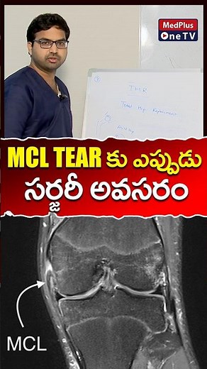 MCL Tear : When is Surgery Needed l Dr. Sai Chandra @MedPlusONETV