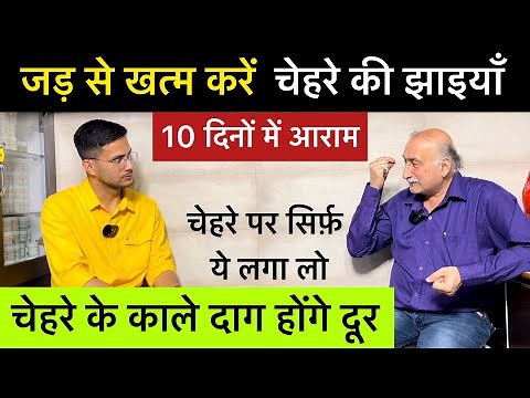 Pigmentation treatment at home | Jhaiya Khatam Karne Ka Tarika | Glowing Skin | Himanshu Bhatt