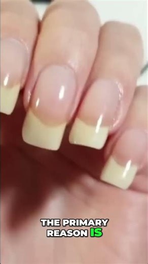 Mysterious White Marks on Nails? You Need to Know This! #shorts