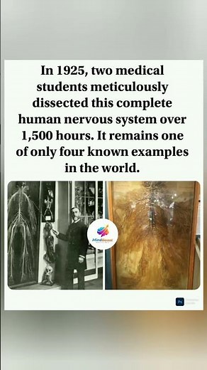 A 1,500-hour masterpiece of medical history. ✨#MedicalHistory #Anatomy #NervousSystem #Dissection