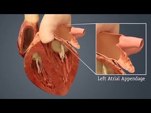 Introduction to WATCHMAN