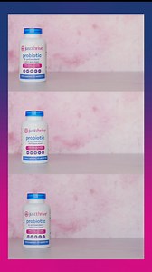 What makes Just Thrive Probiotic stand out? ✨ Clinically proven to arrive 100% alive in the gut ✨ 1000% better survivability than leading brands ✨ Backed by a 100% money-back guarantee Use code: JUST20 and get 20% OFF today! | Just Thrive