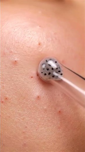 Clarifying Pore Detox — Deep Pull