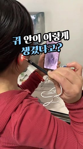 귀 내시경 사용 후기 및 추천 아이템