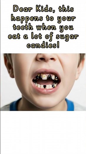 How Candy Causes Cavities 🦷🍬 | Dangers of Too Much Sugar | Tooth Decay Explained