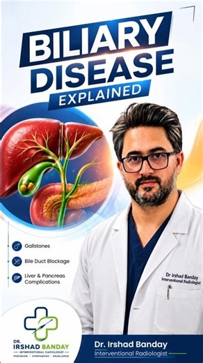 Biliary Stricture & Bile Duct Obstruction: Image-Guided Treatment | Dr. Irshad Banday