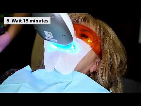 In-Office Whitening with Whiter Image