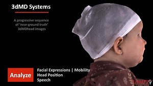 3dMDhead Imaging with Craniometrics May 2025