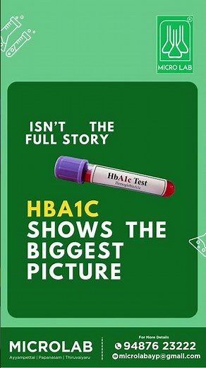 Diabetes Patients Must Know This Test | HbA1c Explained Simply