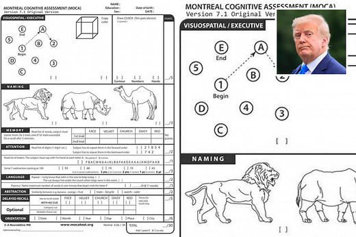 Here’s the cognitive test Trump says he 'aced' – so how well can you do?