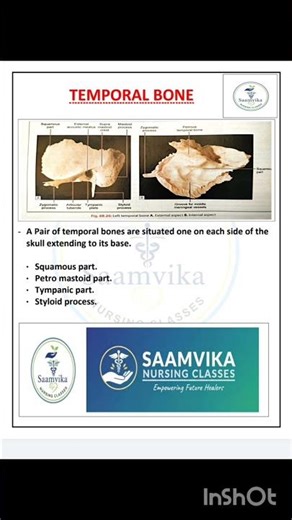Temporal Bone Anatomy | Parts & Features Explained in 1 Minute#shorts#skull