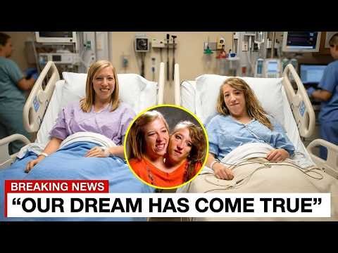 The Conjoined Twins ANNOUNCE We Have Been Separated!