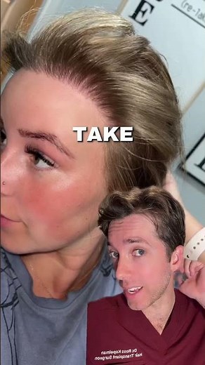 Unshaven Hair Transplants for Women Are Absolutely an Option