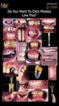 Hn dental innovation | Mobi Ringflash #dental #innovation #dentalclinic #dentalphotography #trend