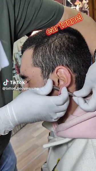 Professional Guide to 10 mm Ear Tunnels