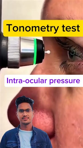 Tonometry test#Tonometry#EyeHealth #Glaucoma#MedicalShorts #HealthTips #shortsfeed #viral #trending