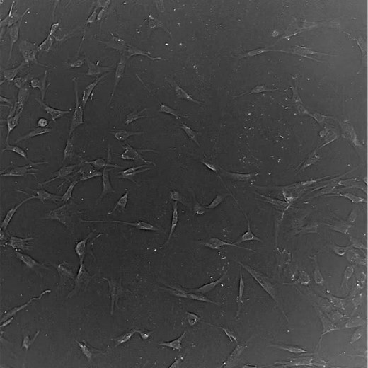 Migration of MSC in 2D Cell Culture