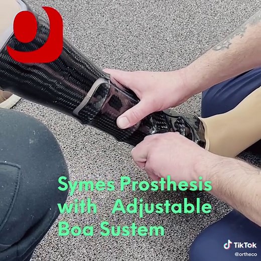 Symes Prosthesis: Comfort and Confidence Restored