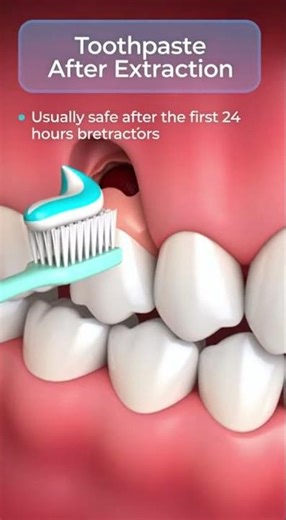 🪥 When can you use toothpaste after a tooth extraction?