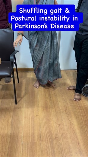 Dr Sudhir Kumar on Instagram: "The patient is a 68-year-old woman with a 10-year history of Parkinson’s disease, presenting with advanced parkinsonian gait dysfunction. She demonstrates marked bradykinetic gait characterized by short shuffling steps, reduced stride length, and poor foot clearance, resulting in audible scuffing of the feet along the ground. There is reduced arm swing (typically bilateral in advanced disease) and difficulty with gait initiation, suggestive of freezing tendency, pa