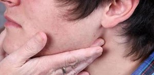 Προσοχή: Πότε το πρήξιμο στον λαιμό είναι σημάδι λεμφώματος